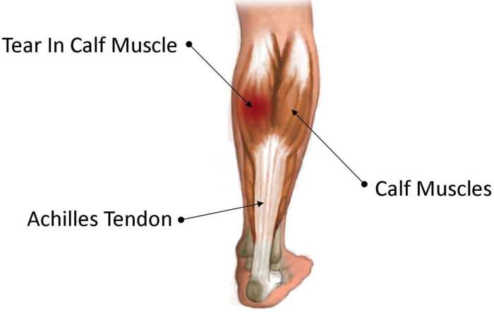 Which muscle is highlighted below apex